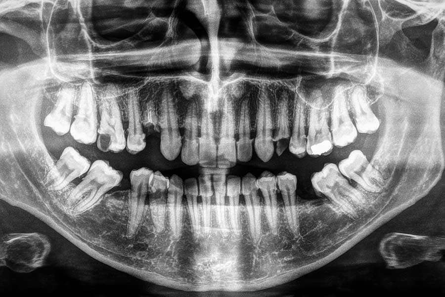 apparecchiature-radiografiche-digitale