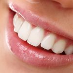 Estetica Dentale a Parma con AKOS Dental Care