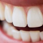 Denti Fissi e Nuovi come prima a Parma: Dentisti Specializzati AKOS