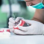 DENTISTA CON LABORATORIO RITOCCHI INTERNO A PARMA: Scopri i Vantaggi in tempi e costi | Studio Dentistico Parma Akos Dental Care