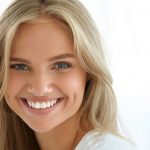 FACCETTE DENTALI PER UN SORRISO CHE VALE! | Dentisti Parma Akos Dental Care: Cosa sono, quanto durano, come si applicano..