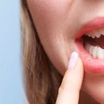 Parodontite Cure e Costi | AKOS Centro Odontoiatrico Dentisti Specializzati a Parma Carpi Modena Reggio Emilia Mantova