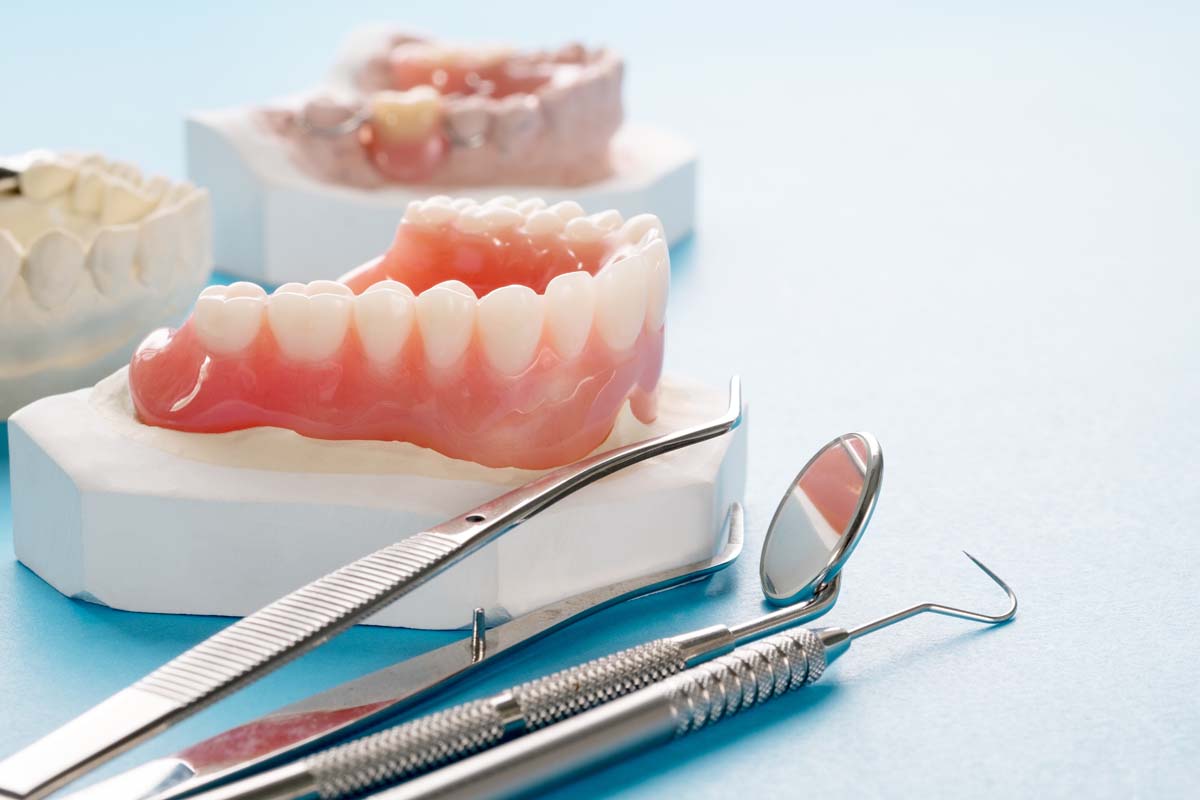 Impianti Dentali e il risparmio che non conviene | AKOS Centro Odontoiatrico Dentisti a Parma Carpi Modena Reggio Emilia Mantova