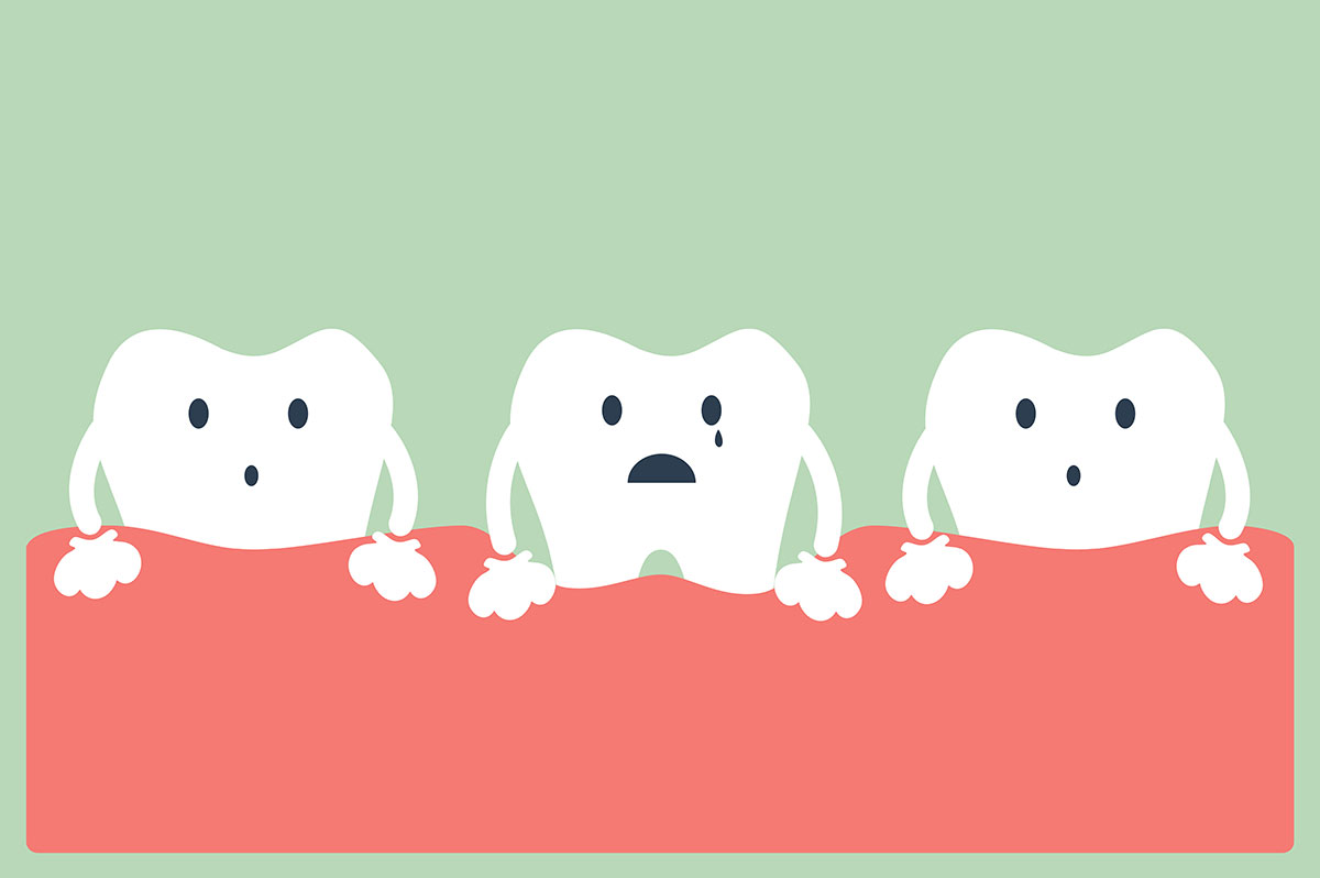 Primi sintomi della Piorrea e cosa fare | AKOS Centro Odontoiatrico Dentisti a Parma Carpi Modena Reggio Emilia Mantova