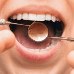 Primi sintomi della Piorrea e cosa fare | AKOS Centro Odontoiatrico Dentisti a Parma Carpi Modena Reggio Emilia Mantova