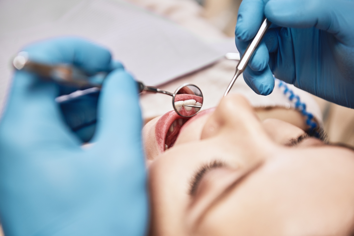 Recessione gengivale ovvero gengive ritirate | AKOS Centro Odontoiatrico Dentisti a Parma Carpi Modena Reggio Emilia Mantova