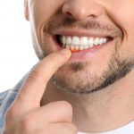 Recessione gengivale ovvero gengive ritirate | AKOS Centro Odontoiatrico Dentisti a Parma Carpi Modena Reggio Emilia Mantova