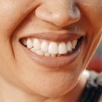 I tre tipi di Malocclusione Dentale | Centro Odontoiatrico AKOS Dental Care Parma Fiorenzuola Piacenza Modena Reggio Emilia Bologna Cremona