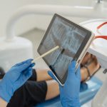 Implantologia Dentale a Carico Immediato | Centro Odontoiatrico AKOS Parma Fiorenzuola Piacenza Modena Reggio Emilia Bologna Cremona