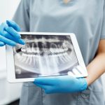 Toronto: Impianto Dentale con Chirurgia Guidata Senza Bisturi Traumi Errori Punti Parma Fiorenzuola Piacenza | AKOS Centro Odontoiatrico