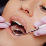 Frattura Dentale: conoscerla è importante ma affidarsi di più.. a Parma Fiorenzuola Piacenza Fidenza AKOS Dental Care Centro Odontoiatrico