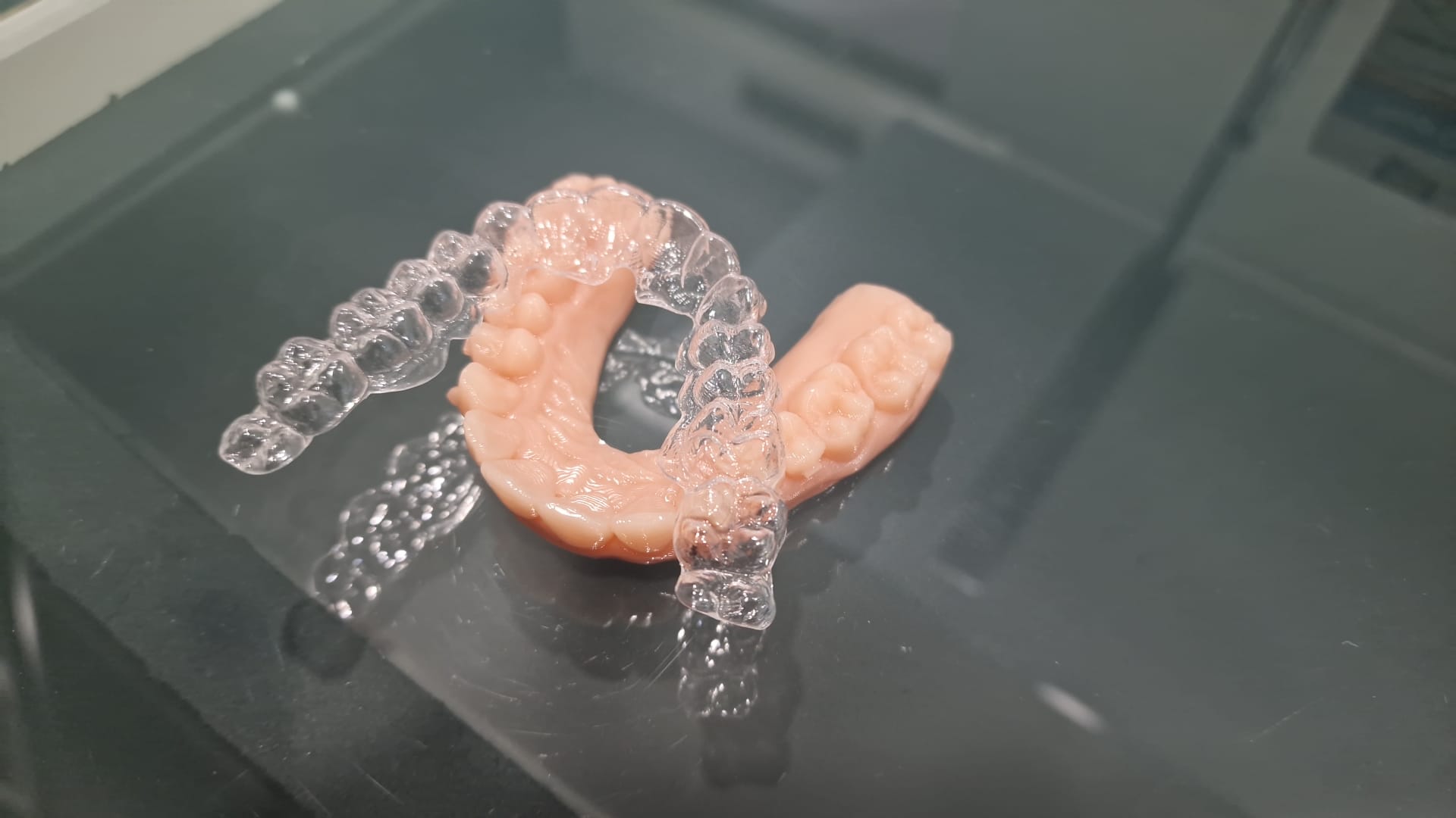 Allineatore dentale trasparente e invisibile: c'è ma non si vede | AKOS Centro Odontoiatrico Dental Care Parma Fiorenzuola Piacenza Fidenza Cremona