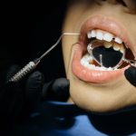 Le carie sui denti da latte e i molari definitivi dei bambini | Centro Odontoiatrico AKOS Dental Care Parma Fiorenzuola Piacenza Fidenza Reggio Emilia