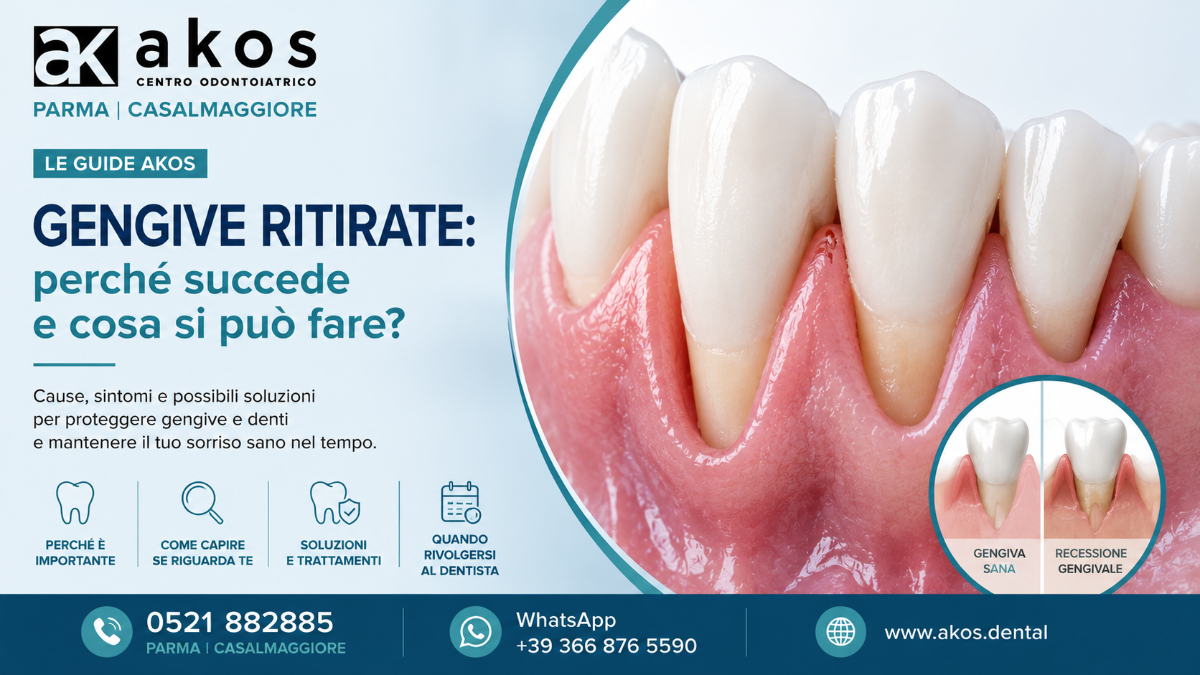 Gengive ritirate? Scopri cause, segnali e possibili trattamenti delle recessioni gengivali con AKOS Centro Odontoiatrico a Parma e Casalmaggiore. | Centro Odontoiatrico Riabilitazioni Orali Complesse AKOS Dental Care Parma Casalmaggiore Fidenza Cremona Fiorenzuola