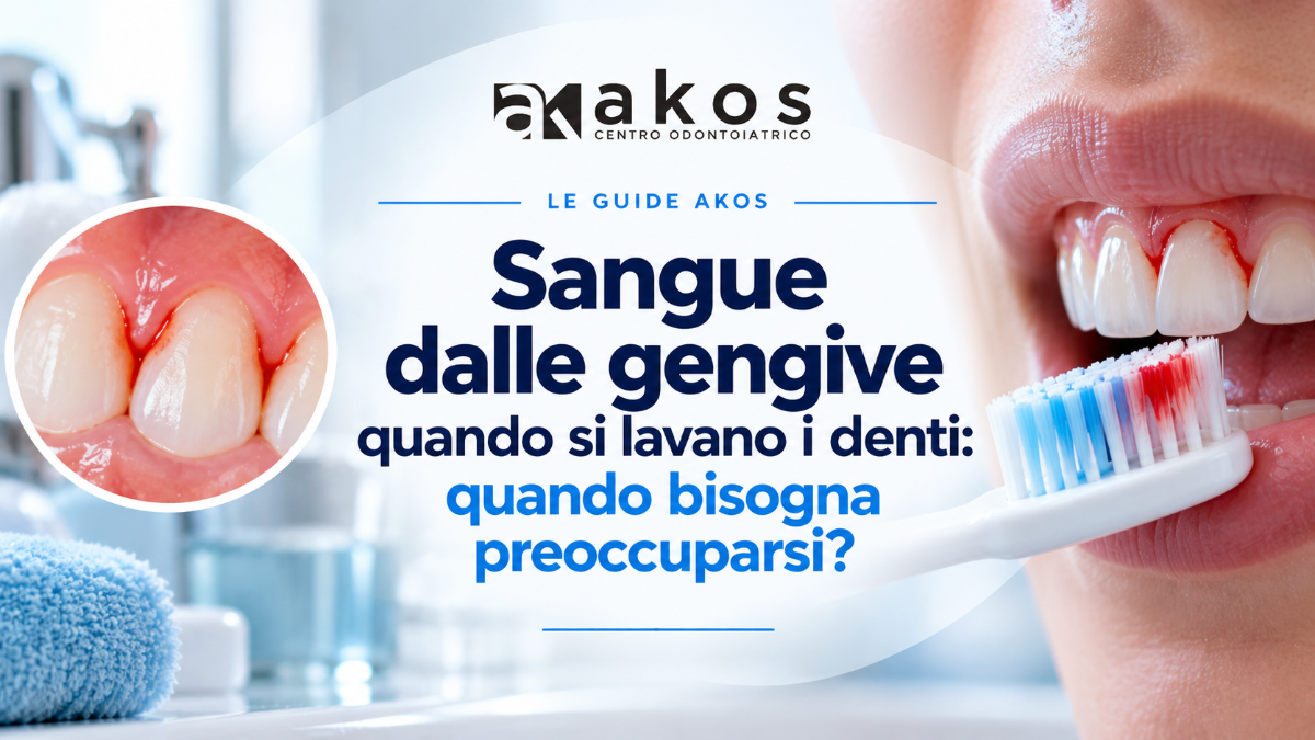 Gengive che sanguinano quando lavi i denti? Scopri le possibili cause, quali segnali osservare e quando è opportuno rivolgersi al dentista. | Centro Odontoiatrico Riabilitazioni Orali Complesse AKOS Dental Care Parma Casalmaggiore Fidenza Cremona Fiorenzuola