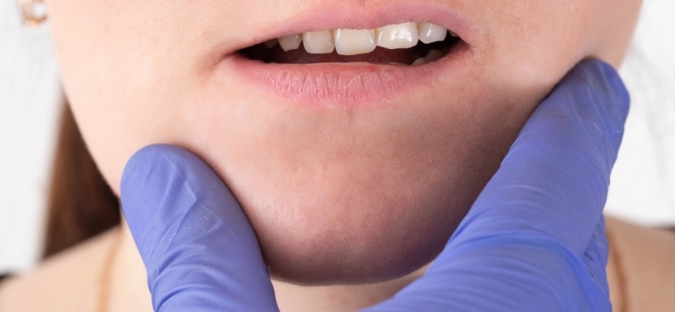 Morso Aperto e Morso Chiuso: quando consultare un Dentista Specializzato in Gnatologia