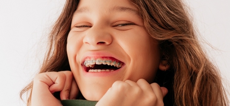 Ortodonzia Intercettiva per bambini: apparecchi e obiettivi