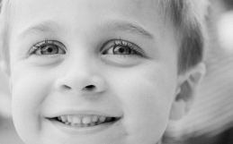 Malocclusioni dentali nei bambini: fondamentale la diagnosi precoce