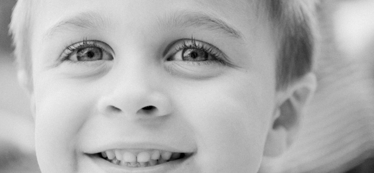 Malocclusioni dentali nei bambini: fondamentale la diagnosi precoce