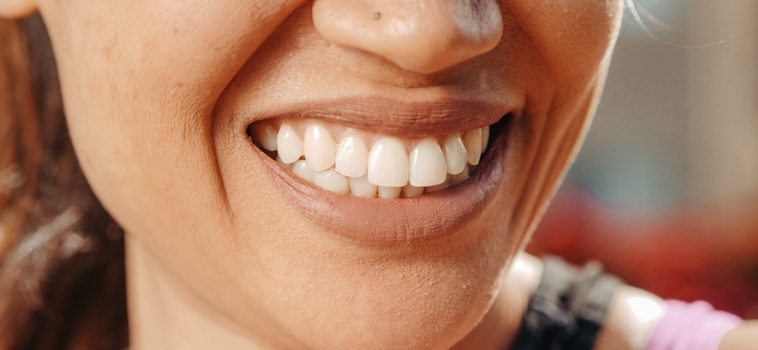 I tre tipi di Malocclusione Dentale